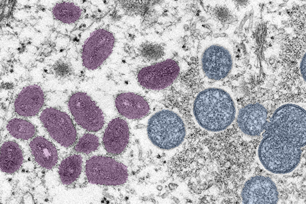 世界卫生组织表示，最近的猴痘疫情“是非典型的”。 (CDC)
