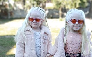 阿根廷夫婦誕下罕見白化雙胞胎 但很健康