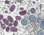 麻州新增6个猴痘病例
