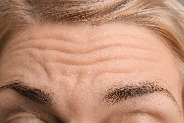 抬頭紋越深的人，與憂愁、焦慮、心血管疾病都有關。(Shutterstock)