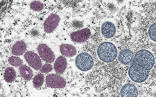 紐約市傳首例兒童感染猴痘
