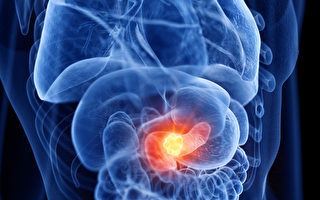 胰臟癌一發現多是晚期！警惕2個徵兆 遠離胰腺癌