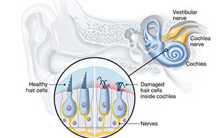 失去的听力还能恢复？研究提供新途径