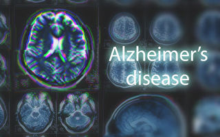 特殊基因突變或有助治療阿茲海默症