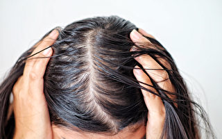 如何對抗頭髮稀疏？ 專家教你幾招