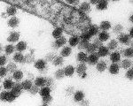 電子顯微鏡下的西尼羅病毒(法新社圖片)