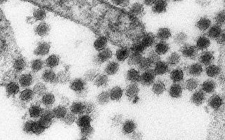 美国发现西尼罗病毒“真面目”