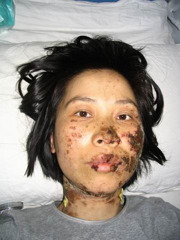 高蓉蓉遭受人格侮辱,頭頂頭發被強行剪短。
