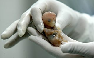 世界罕见异位妊娠病例 上海母亲肝脏切除胚胎