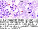 研究：法輪功修煉可雙向調節免疫系統