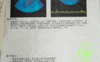 录像：广东卫视证实大陆医院违规换肾