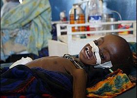 聯合國：非洲中西部三十萬兒童面臨餓死風險