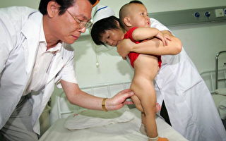 中國缺陷嬰兒 居高發國家之一