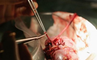 环球邮报：令人担忧的中国器官移植