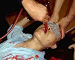 【迫害檔案錄】持續灌食 痛苦吞食胃管
