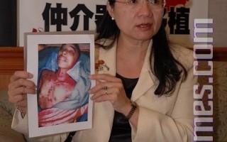 中国医师赴台中介器官移植