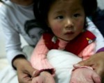 图为安徽阜阳市一名2岁女童染上手足口病。（China Photos/Getty Images）