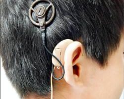 重度聽障裝人工電子耳 不限名額