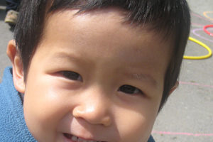两岁华裔男孩时日不多 急需骨髓移植