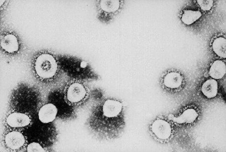 图为CDC的冠状病毒在显微镜下的照片。根据CDC,引起严重急性呼吸系统综合症（SARS）的病毒可能是一个“先前未确认的冠状病毒家族的病毒。图片来源： Getty