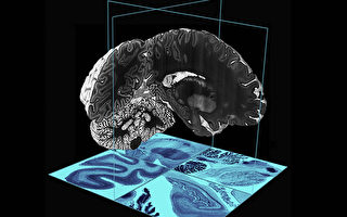 史上最精密 加麦吉尔大学教授研发3D大脑数位模型