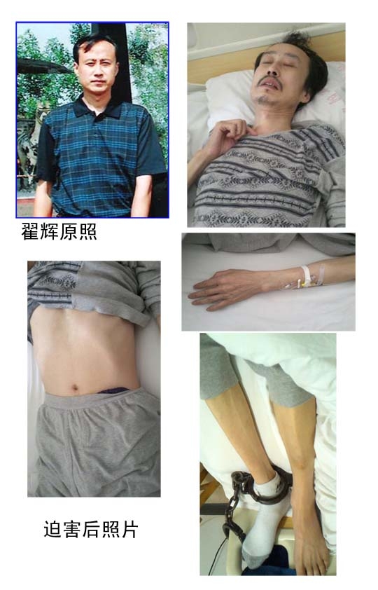 被迫害得奄奄一息的翟輝(圖片來源:明慧網) 被迫害得奄奄一息的翟輝(圖片來源:明慧網)