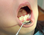 科学家发现牙龈细菌如指纹