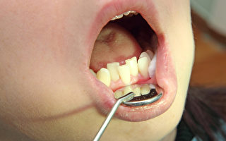 科學家發現牙齦細菌如指紋
