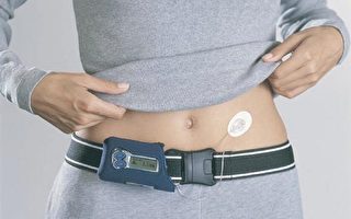 「人造胰腺」 一類糖尿病患者的福音