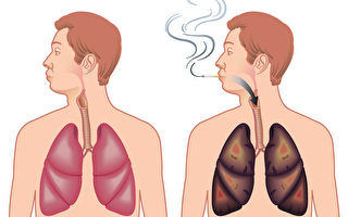 美卫生局局长报告吸烟引发更多健康问题