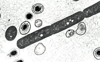美生物安全事故 75科學家恐接觸活炭疽菌