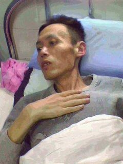 被迫害後的李上榮在醫院,檢查結果顯示肺部已經爛沒了。(明慧網) 被迫害後的李上榮在醫院,檢查結果顯示肺部已經爛沒了。(明慧網)