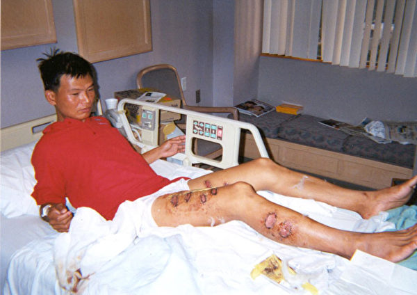 覃永洁被中国警察用烧红的铁条烙伤多处(明慧网) 覃永洁被中国警察用烧红的铁条烙伤多处(明慧网)