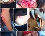 石渠藏人遭鎮壓後一人自殺　一人身亡