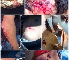 石渠藏人遭鎮壓後一人自殺　一人身亡