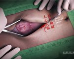 中共“器官移植大会”遭国际医学界抵制