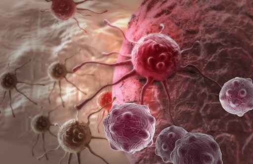 癌細胞能逃避人體的免疫機制，不是因為免疫細胞戰勝不了癌細胞，而是因為免疫細胞認識不了癌細胞。（fotolia）