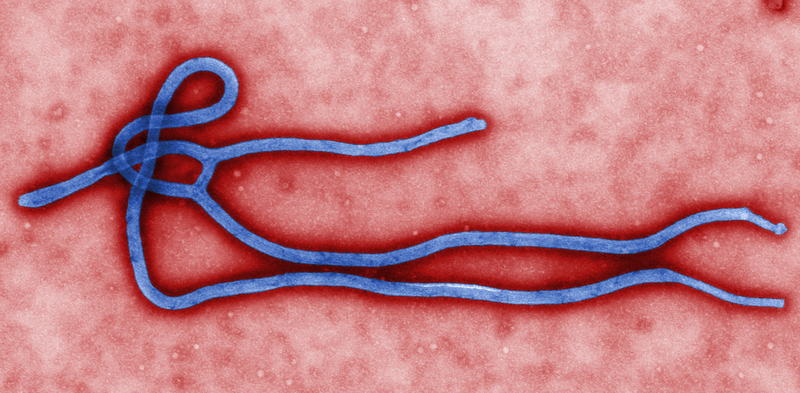 几内亚爆发新的埃博拉疫情埃博拉病毒| 非洲