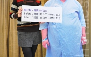 胃縮小瘦54公斤  護理師找回自信