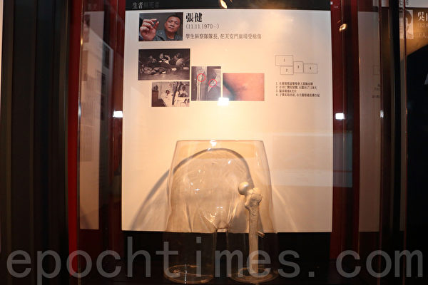 倖存者張健在天安門廣場被連射3槍,變了形的子彈頭,2008年在法國做手術取出。(蔡雯文/大紀元) 倖存者張健在天安門廣場被連射3槍,變了形的子彈頭,2008年在法國做手術取出。(蔡雯文/大紀元)