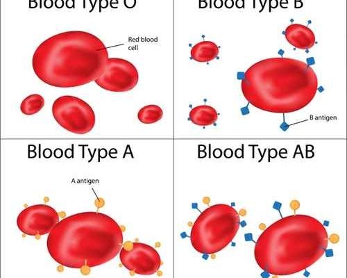 Ab型易患胃癌5种大病和血型相关 大纪元