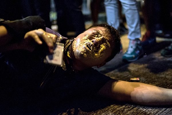 雨傘運動期間,有現場採訪記者佩戴記者證,
仍被警方的胡椒噴霧噴中受傷。(Alex Ogle/AFP/Getty Images) 雨傘運動期間,有現場採訪記者佩戴記者證,
仍被警方的胡椒噴霧噴中受傷。(Alex Ogle/AFP/Getty Images)