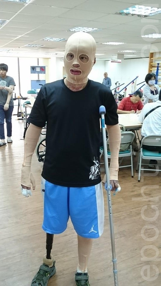 晏祥从坐在轮椅上,到现在可以用义肢走路。(方金媛/大纪元) 晏祥从坐在轮椅上,到现在可以用义肢走路。(方金媛/大纪元)