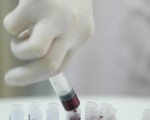 日本研發測癌感應器 呼一口氣即知結果