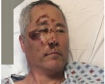 紐約亞裔男昏迷街頭且失語 警方徵集線索