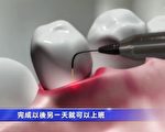 近十年來，微創激光應用在牙科的技術開始普及，也讓人容易接受。（新唐人電視台視頻截圖）