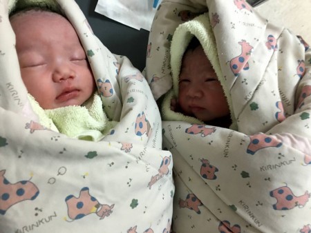 亚洲首对连体婴弟忠仁喜获龙凤胎 亚洲首对连体婴弟忠仁喜获龙凤胎