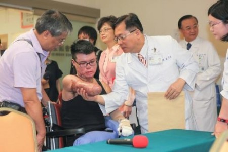 臺八仙塵爆週年 傷者努力浴火重生 臺八仙塵爆週年 傷者努力浴火重生