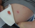 華裔男街頭中BB槍 腿被鋼珠打出血