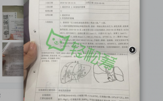 網曝「肝衰竭」患者上海華山醫院當天肝移植